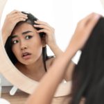 Simple and Hair-Safe Ways to Combat Dandruff