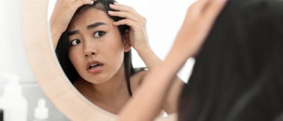 Simple and Hair-Safe Ways to Combat Dandruff