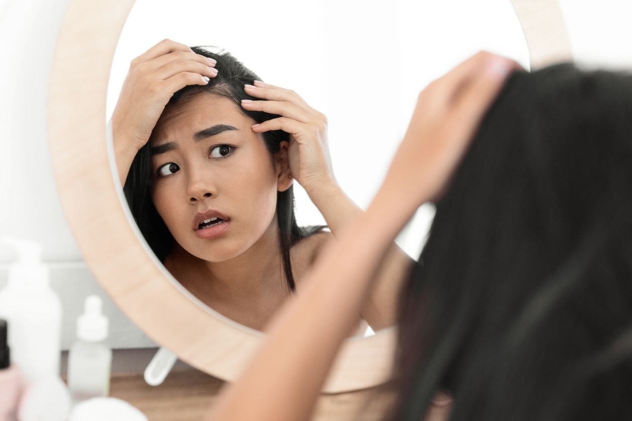 Simple and Hair-Safe Ways to Combat Dandruff