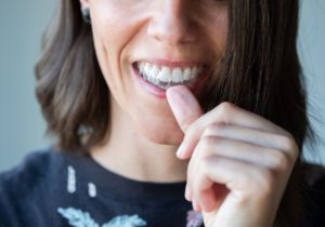 What To Expect in the First Week of Invisalign Treatment