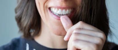 What To Expect in the First Week of Invisalign Treatment