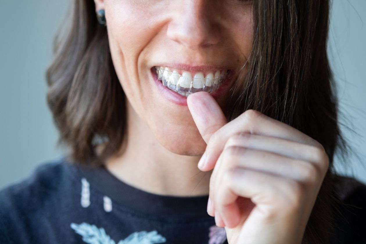 What To Expect in the First Week of Invisalign Treatment
