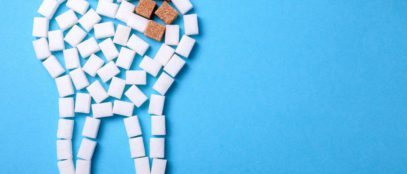 Recognizing the Different Stages of Tooth Decay