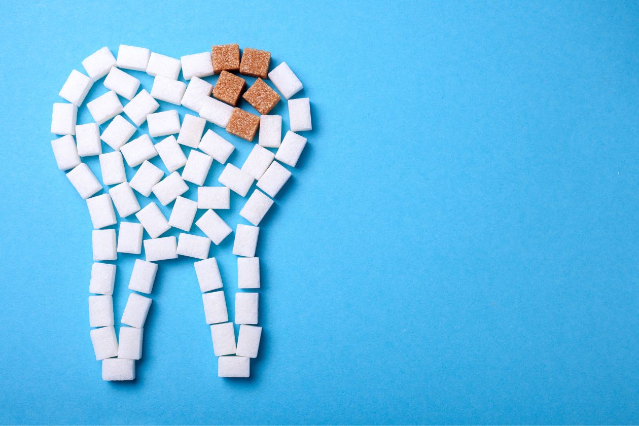 Recognizing the Different Stages of Tooth Decay