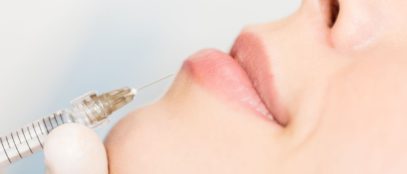 What Are Dermal Fillers and Are They for You?