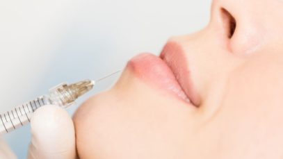 What Are Dermal Fillers and Are They for You?