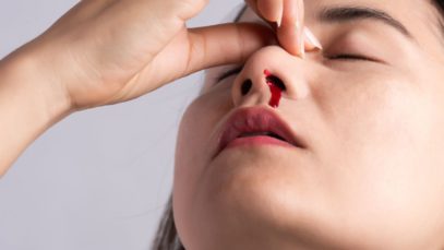 Debunking Common First Aid Myths and Old Wives’ Tales